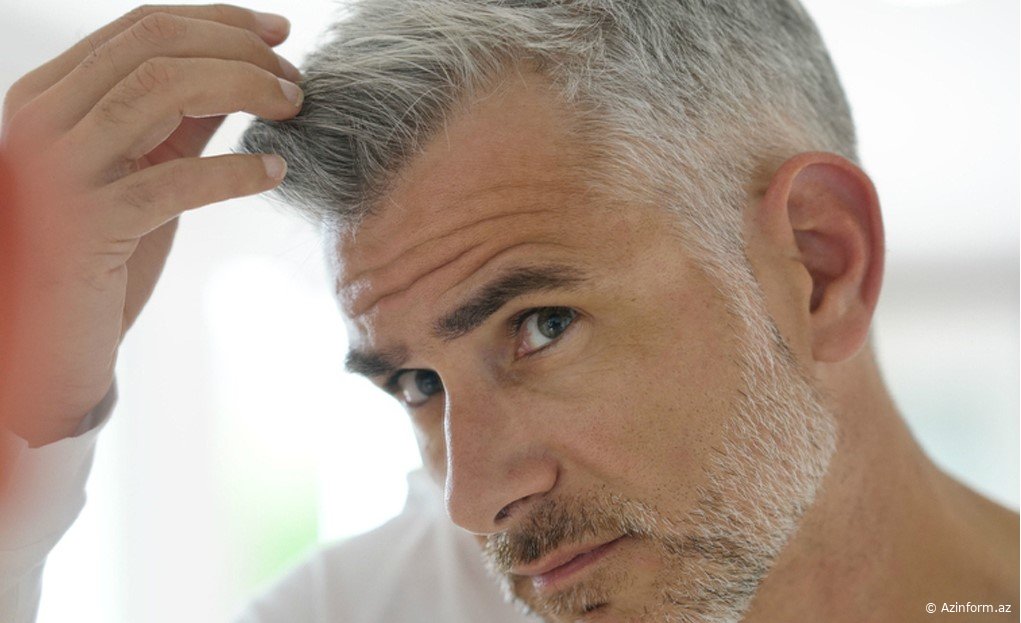 Saçlarınızın birdən ağarmasının səbəbi tapıldı - "Bədəninizdə bu 3 vitamin əskikdirsə..."